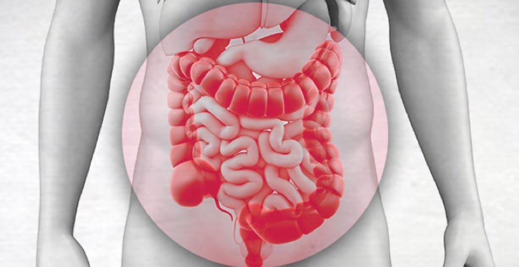 HIPEC (Hyperthermic Intraperitoneal Chemotherapy)